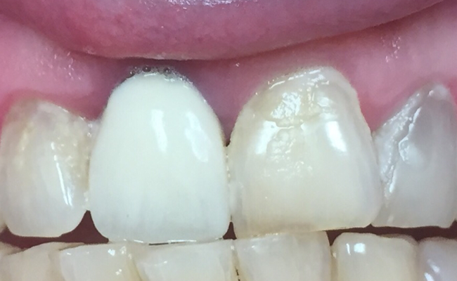Smile Gallery